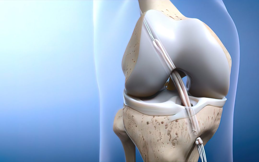 ACL Reconstruction – It’s All About Timing
